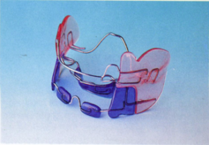 apparecchi denti per bambini